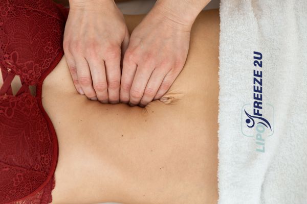 diastasis recti treatment Kilmarnock