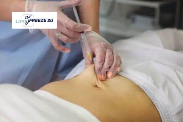 How Does Aqualyx Fat Dissolving Injection Work to Break Down Fat Kilmarnock?