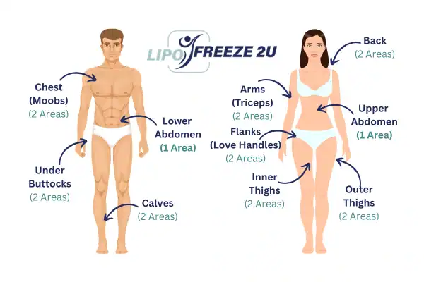 Areas you can have fat freezing treatment Kilmarnock