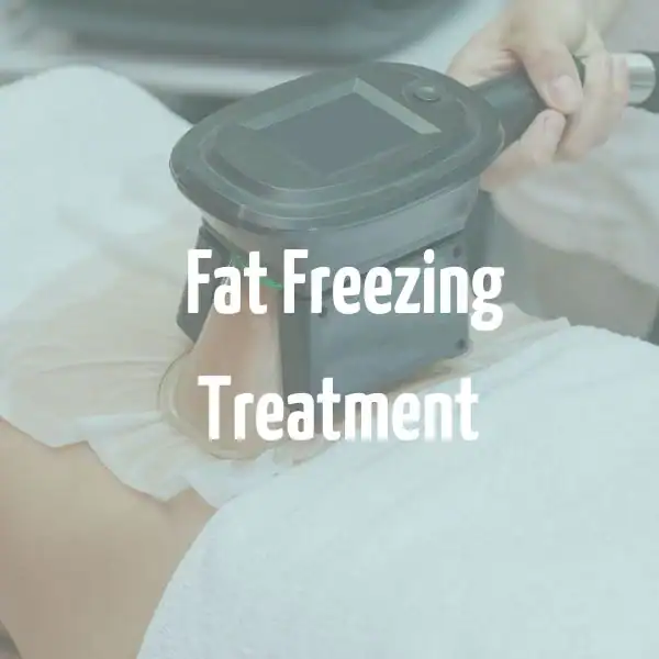fat freezing treatment Kilmarnock