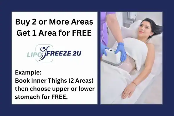 fat freezing prices Kilmarnock