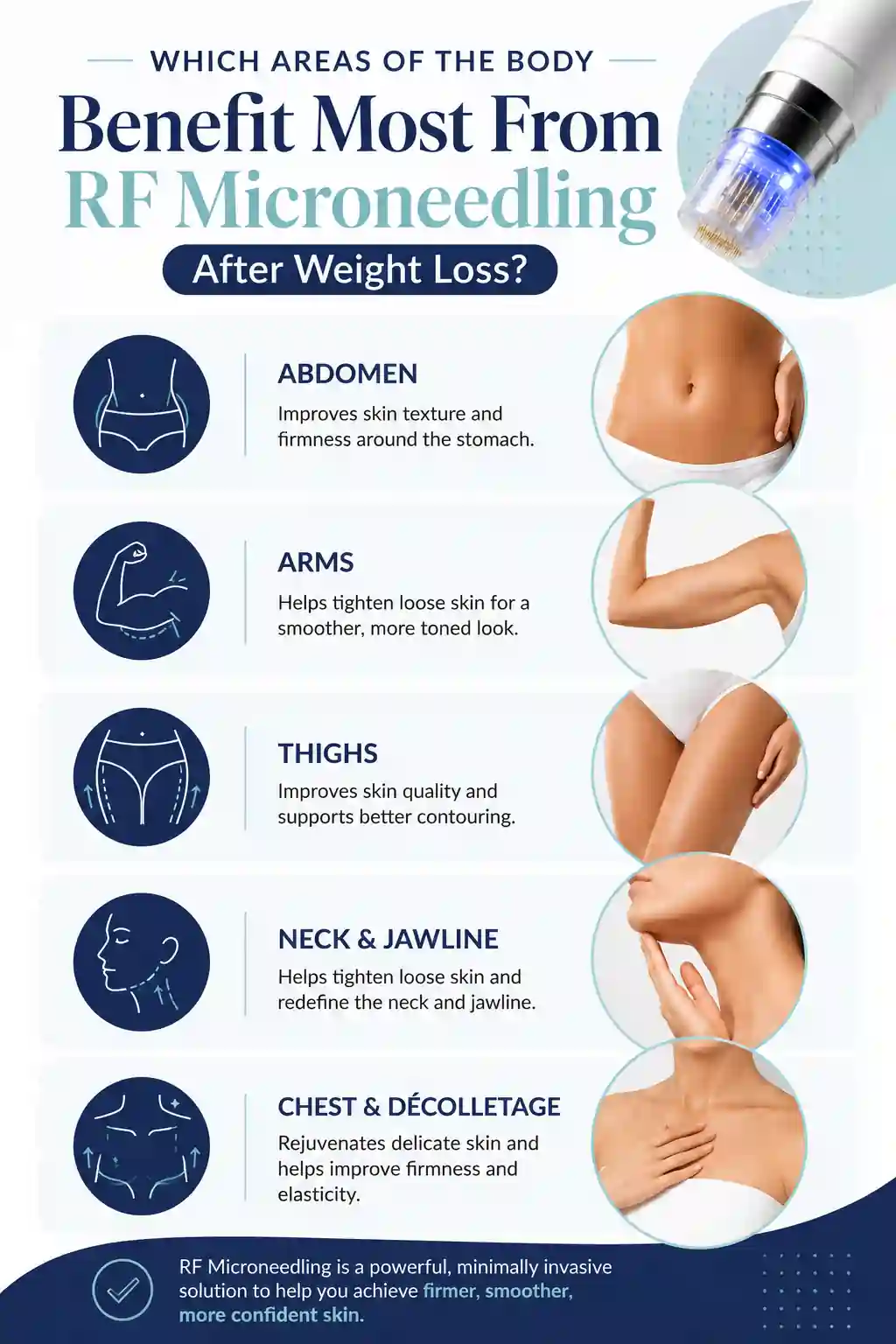 Which Areas of the Body Benefit Most From RF Microneedling After Weight Loss Kilmarnock